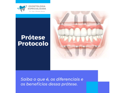 Prótese Protocolo