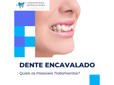 Dente Encavalado – Quais os Possíveis Tratamentos?