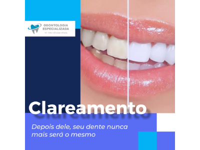 Clareamento: depois dele, seu dente nunca mais será o mesmo