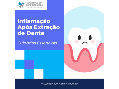 Inflamação Após Extração de Dente – Cuidados Essenciais